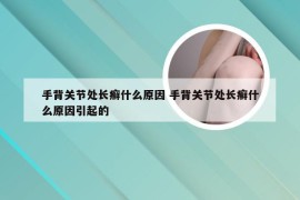 手背关节处长癣什么原因 手背关节处长癣什么原因引起的