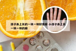 孩子身上长的一块一块好像癣 小孩子身上长一块一块的癣