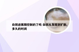 白斑进展期控制的了吗 白斑从发现到扩散,多久的时间