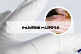 什么软膏擦癣 什么药膏管癣