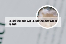 小孩脸上起癣怎么办 小孩脸上起癣什么原因导致的