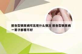 脓包型银屑病可出现什么情况 脓包型银屑病一辈子都看不好