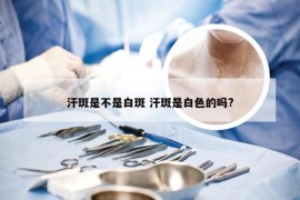 汗斑是不是白斑 汗斑是白色的吗?