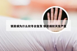 银屑病为什么秋冬会复发 银屑病秋天变严重