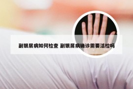 副银屑病如何检查 副银屑病确诊需要活检吗