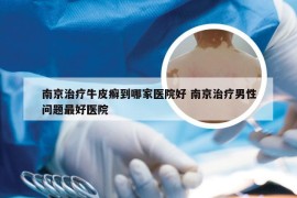 南京治疗牛皮癣到哪家医院好 南京治疗男性问题最好医院