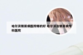 哈尔滨银屑病医院哪的好 哈尔滨治银屑病专科医院