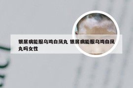 银屑病能服乌鸡白凤丸 银屑病能服乌鸡白凤丸吗女性