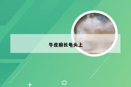 牛皮癣长龟头上