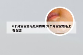 6个月宝宝眉毛处有白斑 六个月宝宝眉毛上有白斑