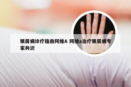 银屑病诊疗指南阿维A 阿维a治疗银屑病专家共识