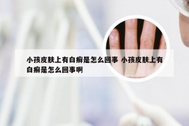 小孩皮肤上有白癣是怎么回事 小孩皮肤上有白癣是怎么回事啊