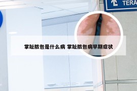 掌趾脓包是什么病 掌趾脓包病早期症状