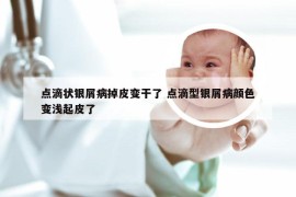 点滴状银屑病掉皮变干了 点滴型银屑病颜色变浅起皮了