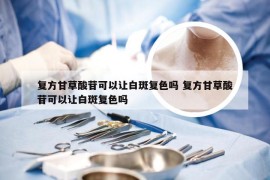 复方甘草酸苷可以让白斑复色吗 复方甘草酸苷可以让白斑复色吗