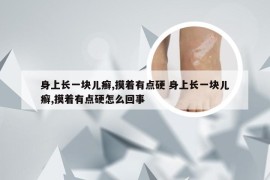 身上长一块儿癣,摸着有点硬 身上长一块儿癣,摸着有点硬怎么回事