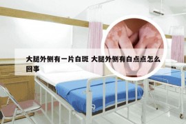 大腿外侧有一片白斑 大腿外侧有白点点怎么回事