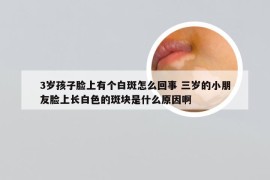 3岁孩子脸上有个白斑怎么回事 三岁的小朋友脸上长白色的斑块是什么原因啊