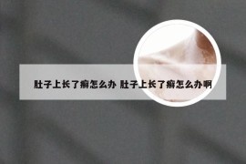 肚子上长了癣怎么办 肚子上长了癣怎么办啊