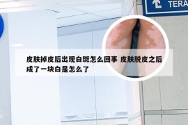 皮肤掉皮后出现白斑怎么回事 皮肤脱皮之后成了一块白是怎么了