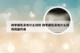 四季癣乳膏有什么功效 四季癣乳膏有什么功效和副作用