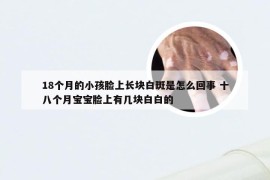 18个月的小孩脸上长块白斑是怎么回事 十八个月宝宝脸上有几块白白的