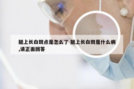 腿上长白斑点是怎么了 腿上长白斑是什么病,请正面回答