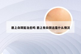 唇上白斑能治愈吗 唇上有白斑这是什么情况