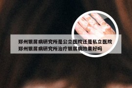 郑州银屑病研究所是公立医院还是私立医院 郑州银屑病研究所治疗银屑病效果好吗