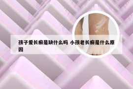 孩子爱长癣是缺什么吗 小孩老长癣是什么原因