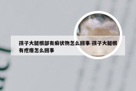 孩子大腿根部有癣状物怎么回事 孩子大腿根有疙瘩怎么回事