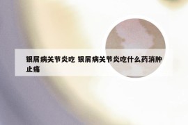 银屑病关节炎吃 银屑病关节炎吃什么药消肿止痛