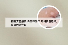 妇科真菌感染,白斑咋治疗 妇科真菌感染,白斑咋治疗好