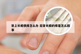 背上长癣很痒怎么办 后背长癣的痒是怎么回事