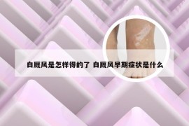 白厩风是怎样得的了 白厩风早期症状是什么