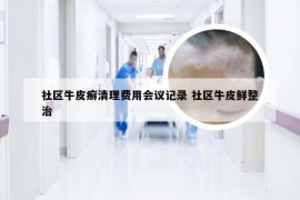 社区牛皮癣清理费用会议记录 社区牛皮鲜整治