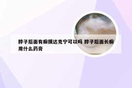 脖子后面有癣摸达克宁可以吗 脖子后面长癣用什么药膏