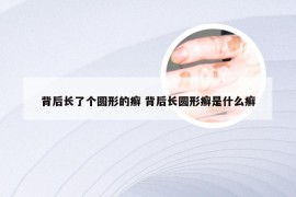 背后长了个圆形的癣 背后长圆形癣是什么癣