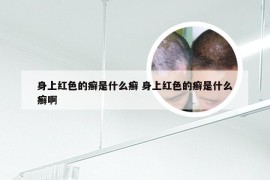 身上红色的癣是什么癣 身上红色的癣是什么癣啊