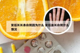 背后长长条白斑因为什么 背后面长白斑什么情况