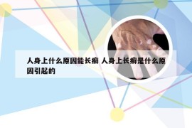 人身上什么原因能长癣 人身上长癣是什么原因引起的