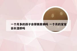 一个月多的孩子会得银屑病吗 一个月的宝宝会长湿疹吗