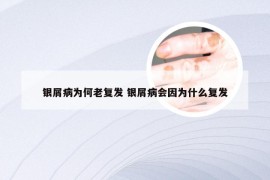 银屑病为何老复发 银屑病会因为什么复发