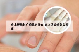 身上经常长广癣是为什么 身上总长癣怎么回事