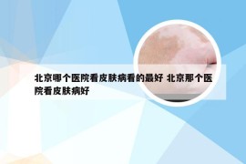 北京哪个医院看皮肤病看的最好 北京那个医院看皮肤病好