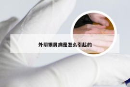 外阴银屑病是怎么引起的