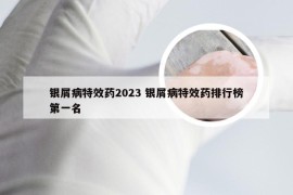 银屑病特效药2023 银屑病特效药排行榜第一名