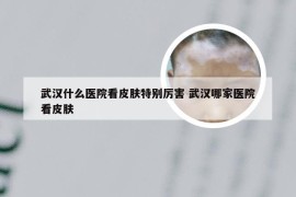 武汉什么医院看皮肤特别厉害 武汉哪家医院看皮肤