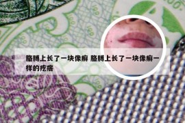 胳膊上长了一块像癣 胳膊上长了一块像癣一样的疙瘩