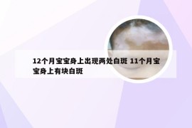 12个月宝宝身上出现两处白斑 11个月宝宝身上有块白斑